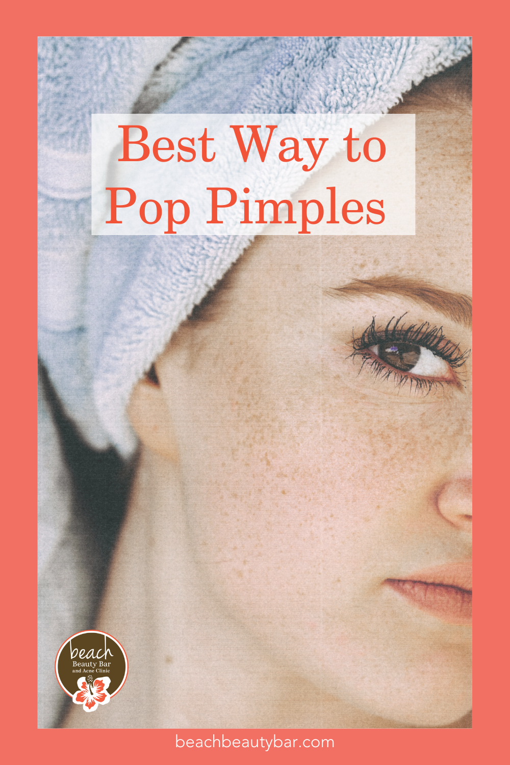 should-you-pop-your-pimples-beach-beauty-bar-and-acne-clinic